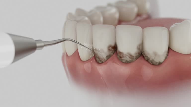 Trusted Teeth Cleaning And Checkup service in Shamokin, PA - Dentist Open Now